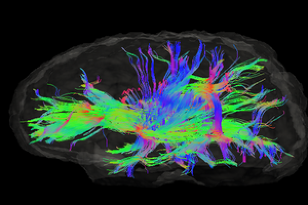 Fiber networks in the brain